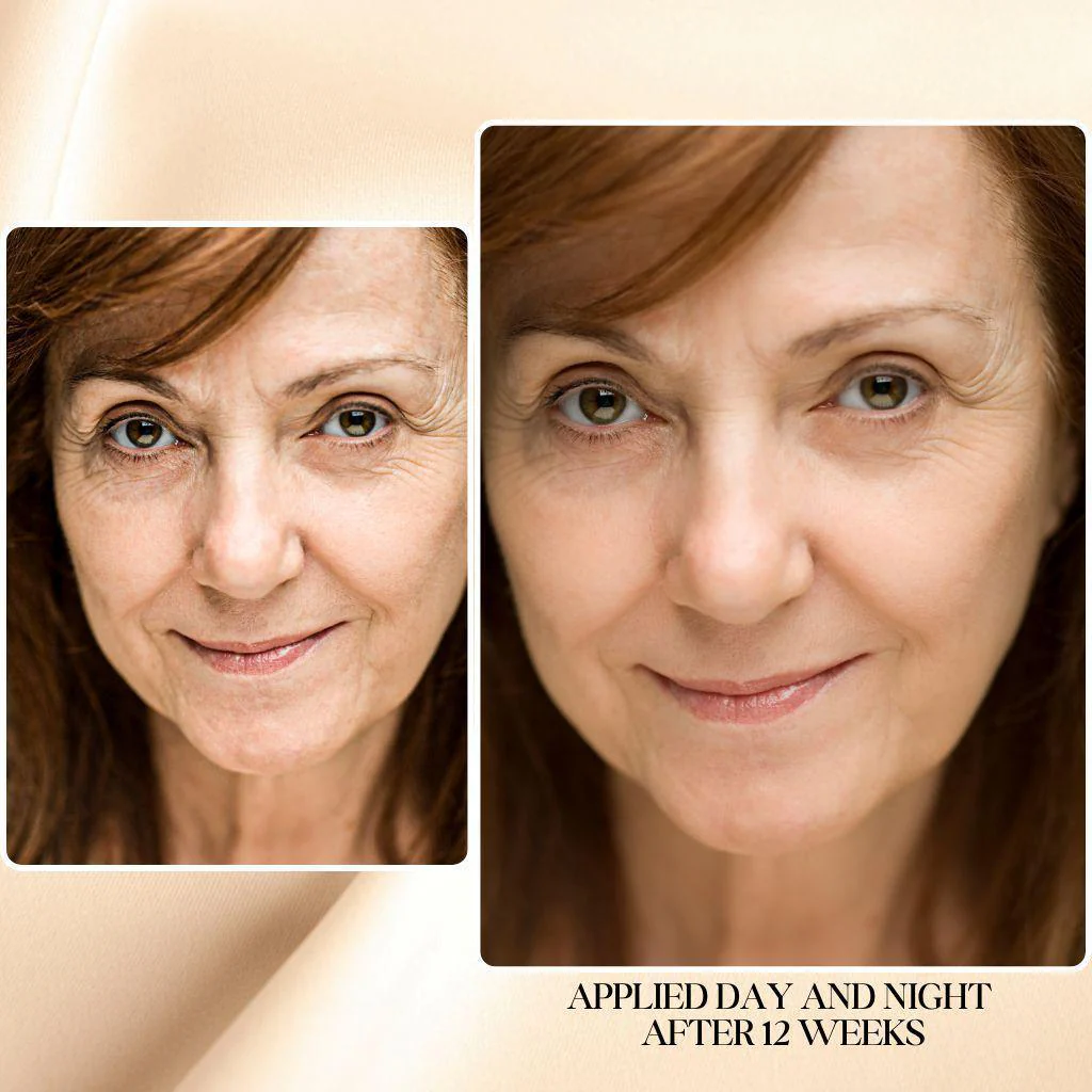 Anti-Aging Bundle, Large - Image 13