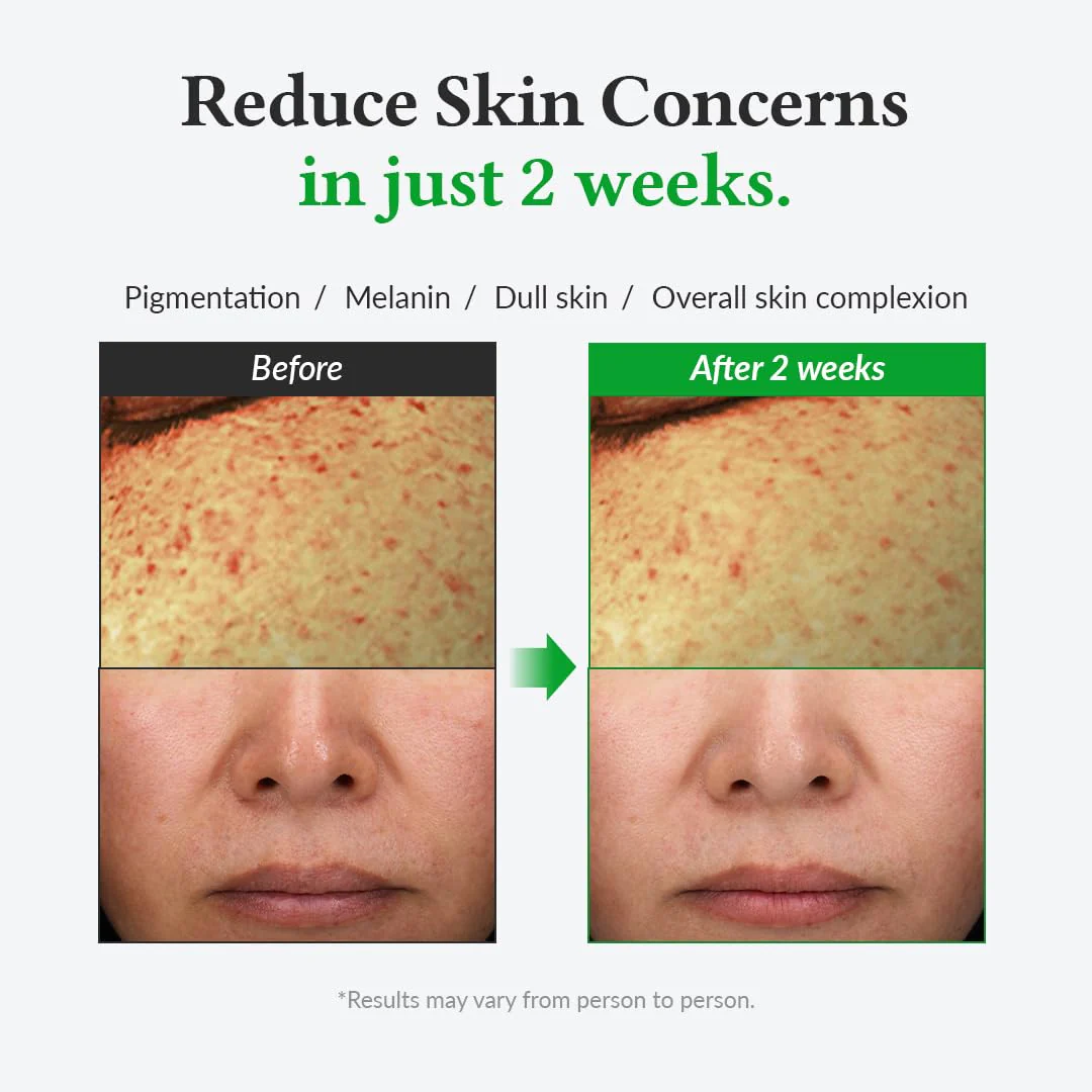 Dr. Althea Gentle Vitamin C Serum - Image 3