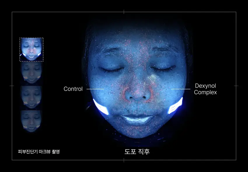 PERCENT SCIENCE Dexynol-16.3 Set. - Acne/Trouble - Image 6